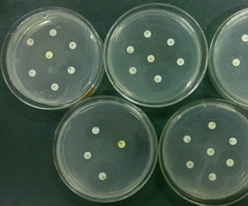 圖1-18 藥敏試驗結果